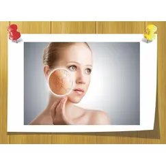 Ceramide Complex CLR, Вес: 25 гр