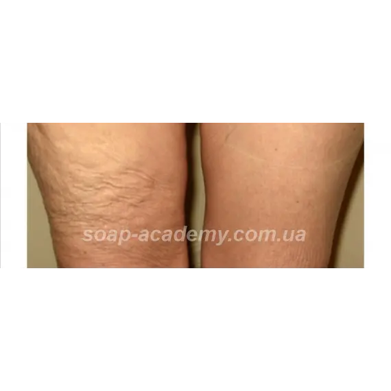 Антицеллюлитный компонент Lipofirm LWC